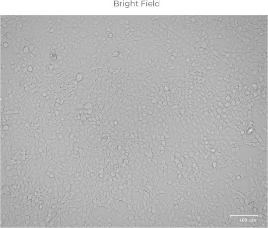 Bright Field