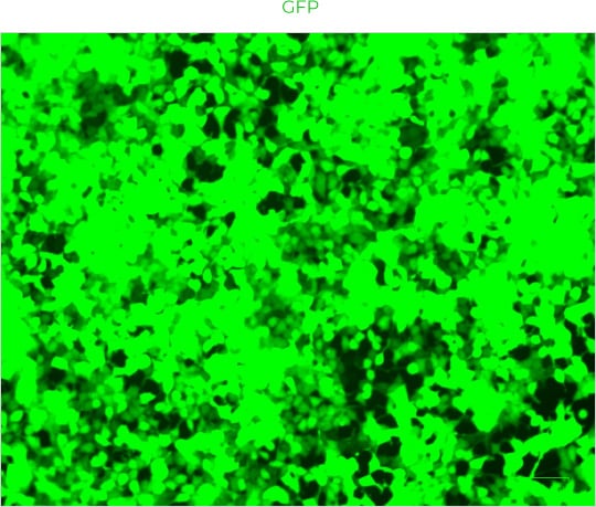 GFP