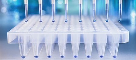 Primary Immunodeficiencies