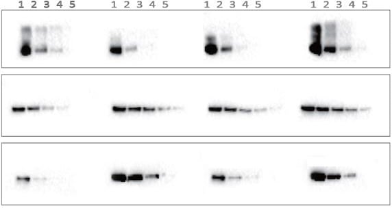 Why Choose eBlot™ L1- comparison