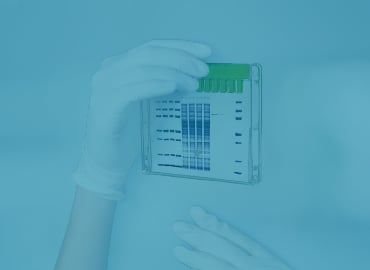 SurePAGE™ Precast Gels