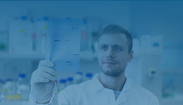 Protein Electrophoresis and Blotting